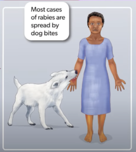 rabies by dog bite