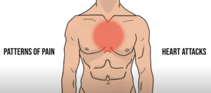 chest pain at center