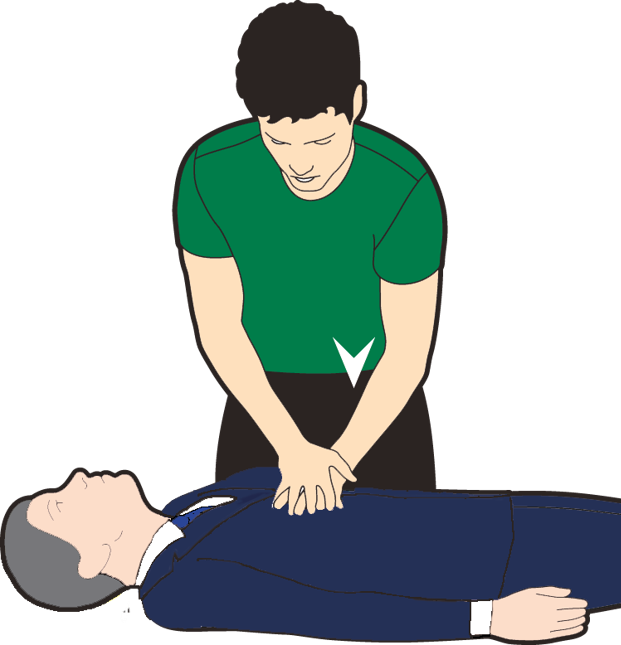 cpr in case of heart attack
