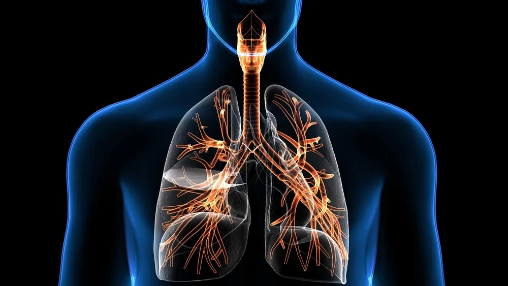 All those conditions in which patient's lungs are so damaged that he can't breathe properly and can't maintain his oxygen.