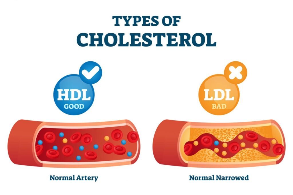 LDL cholesterol level (i.e. bad cholesterol) and  HDL cholesterol