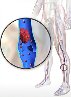 Anti-Thrombi Properties