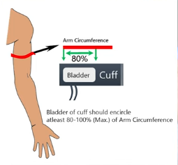 What are the Cuff Sizes