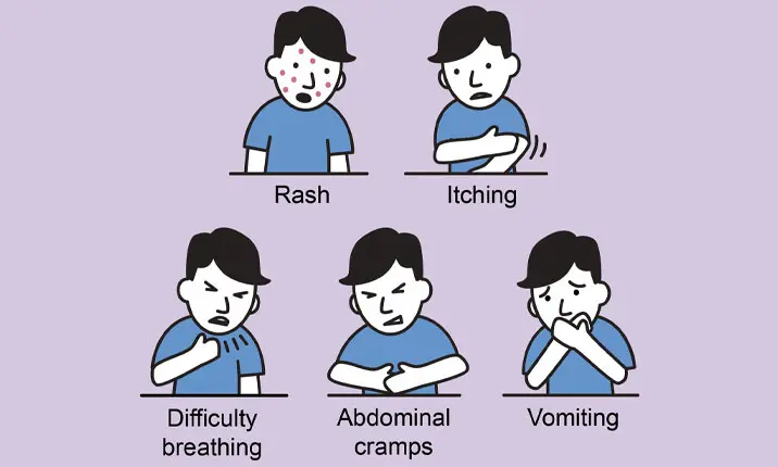 Signs and Symptoms of Drug Allergy
