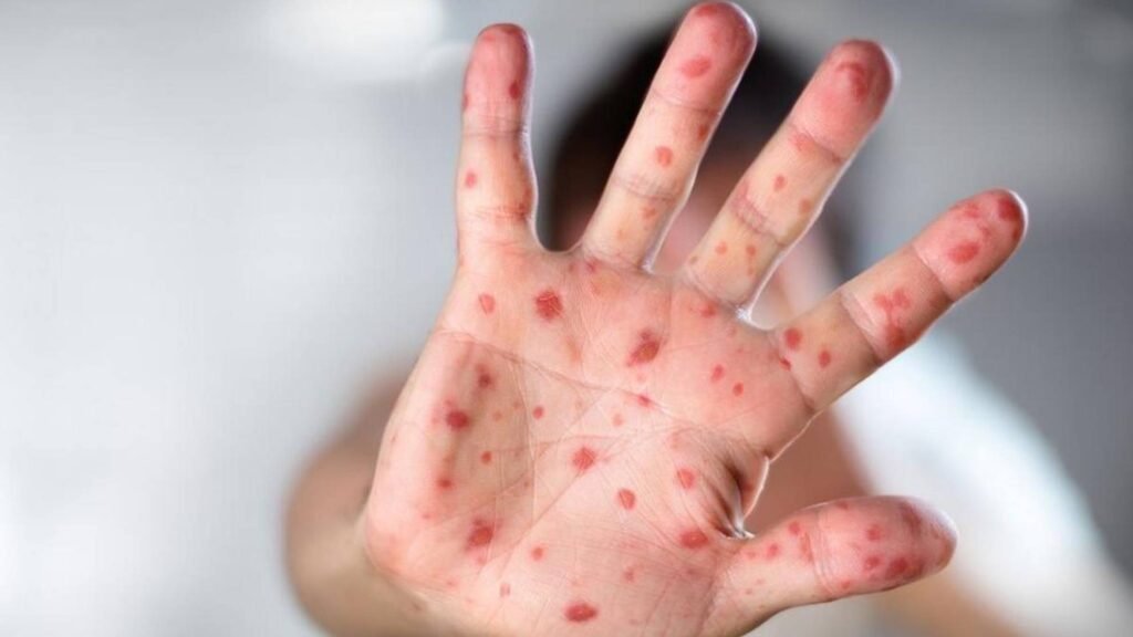 they leave marks