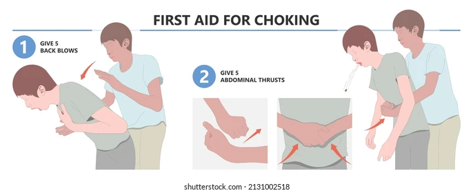 choking-first-aid-baby-food