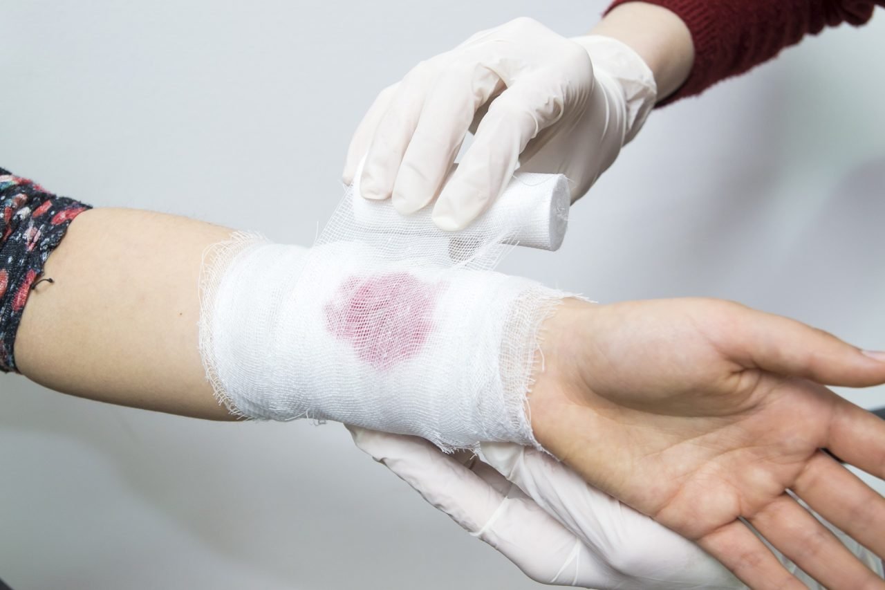 BLEEDING FIRST AID TREATMENT